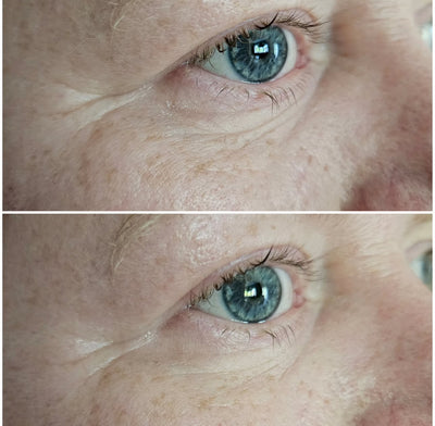 Bright Eyed Firm - Smooth Hydragel Mask